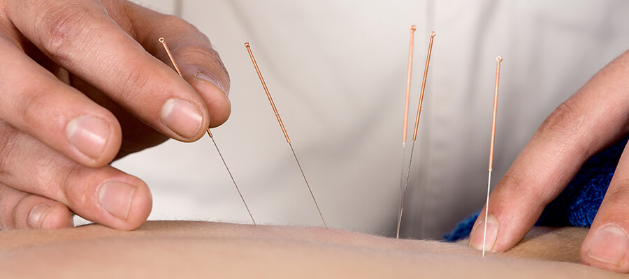 Acupuncture & Acupressure in Tulsa, OK